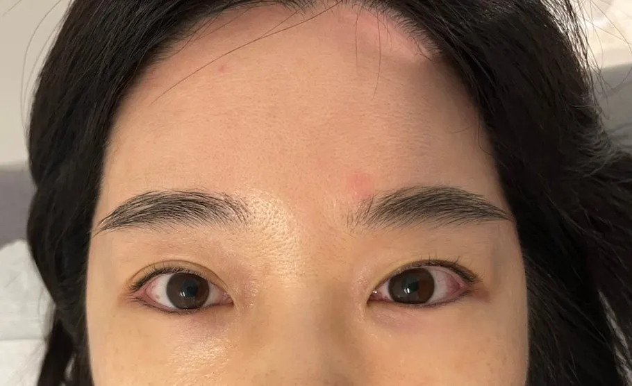 Comparison shot of eyes before the lash lift