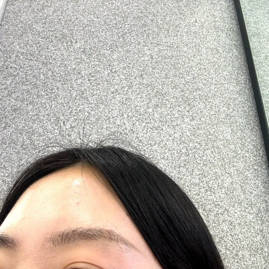 눈썹 라인 주변 잔털 비포 모습