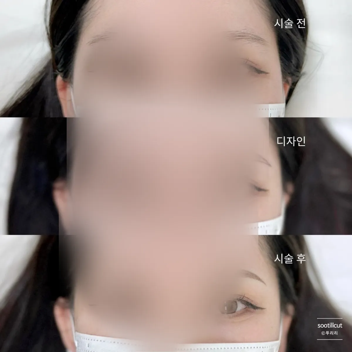 시에르브로우 눈썹 반영구 시술 대표 이미지