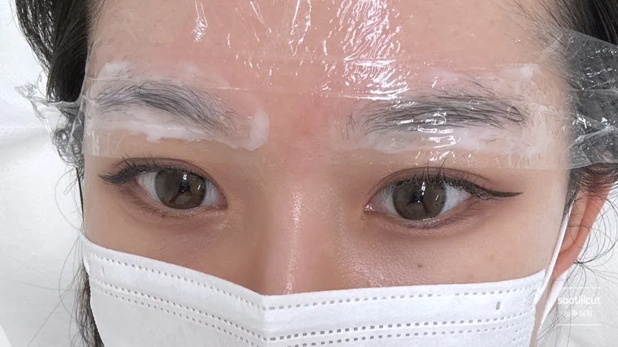 마취크림을 바른 시술 전 눈썹