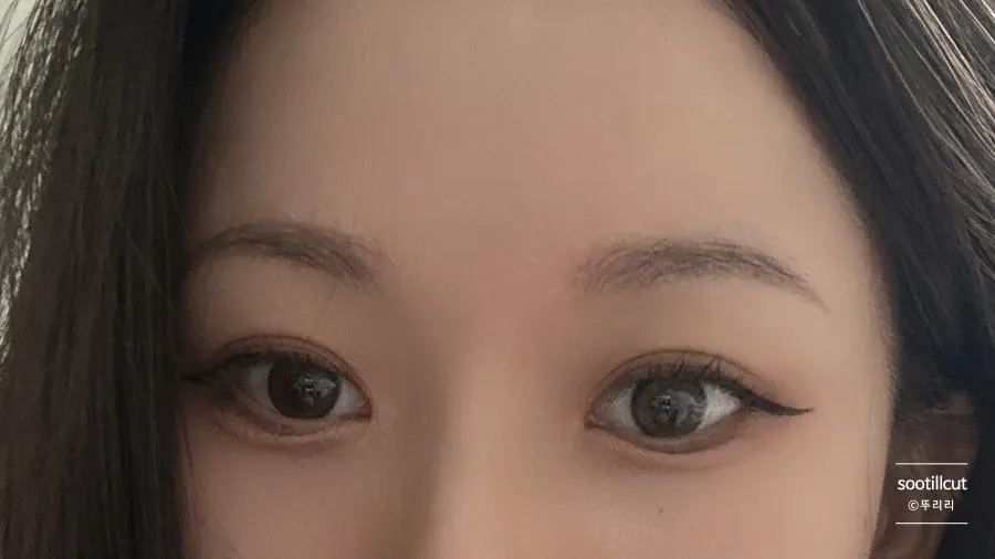 시술 5일차 자연스러워진 눈썹