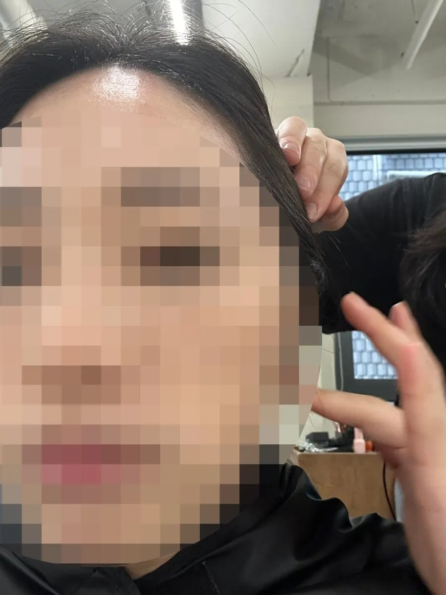 Applying scalp protector before the service