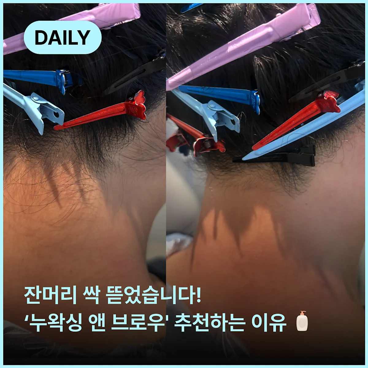 Main photo of hairline waxing at Nu Waxing & Brow near Gangnam Station