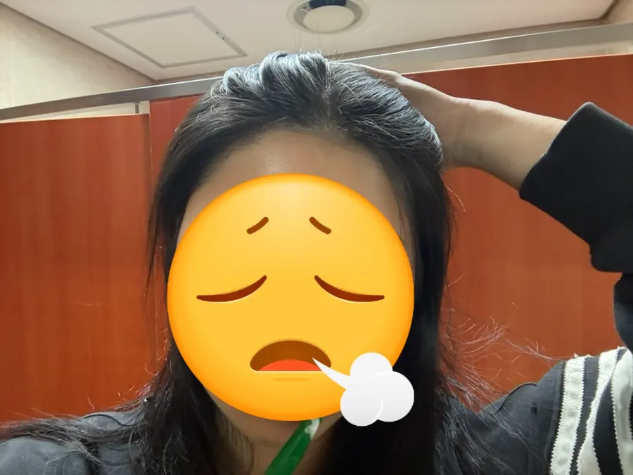 Stray hairline hairs grown forward before waxing