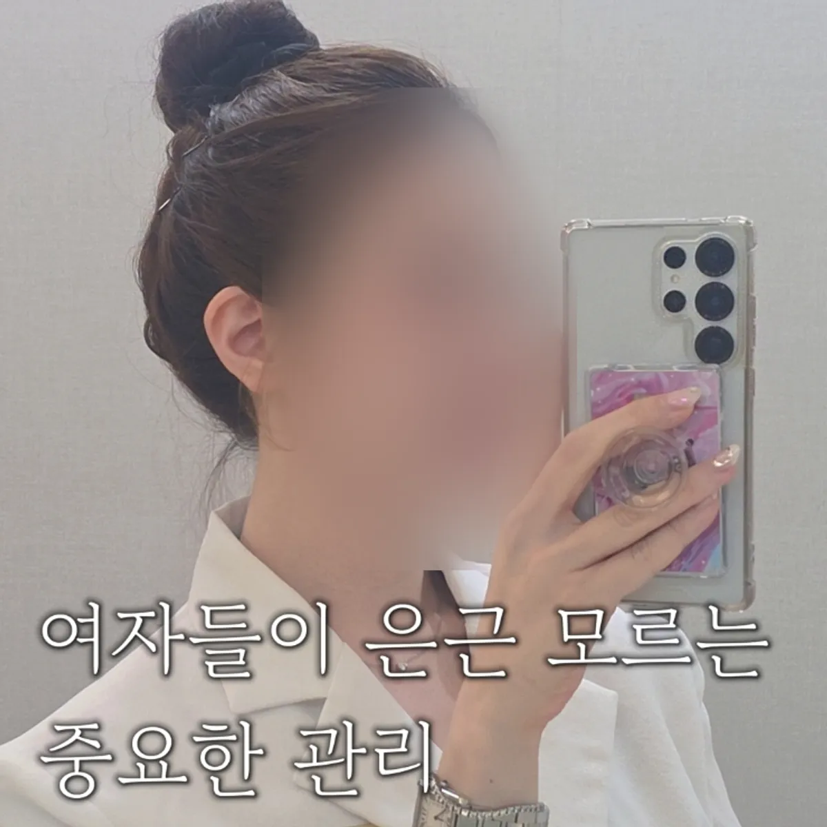 Front view of a woman's M-shape hairline corrected with hair stroke