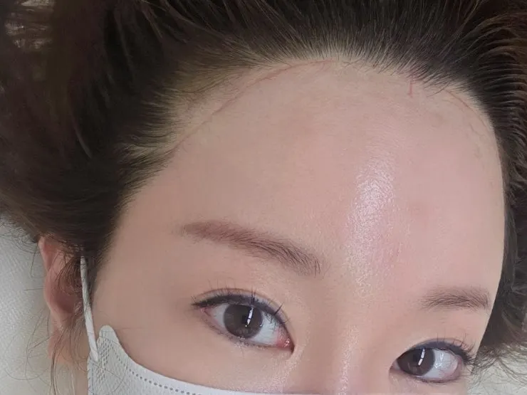 Second hairline design with each strand drawn individually