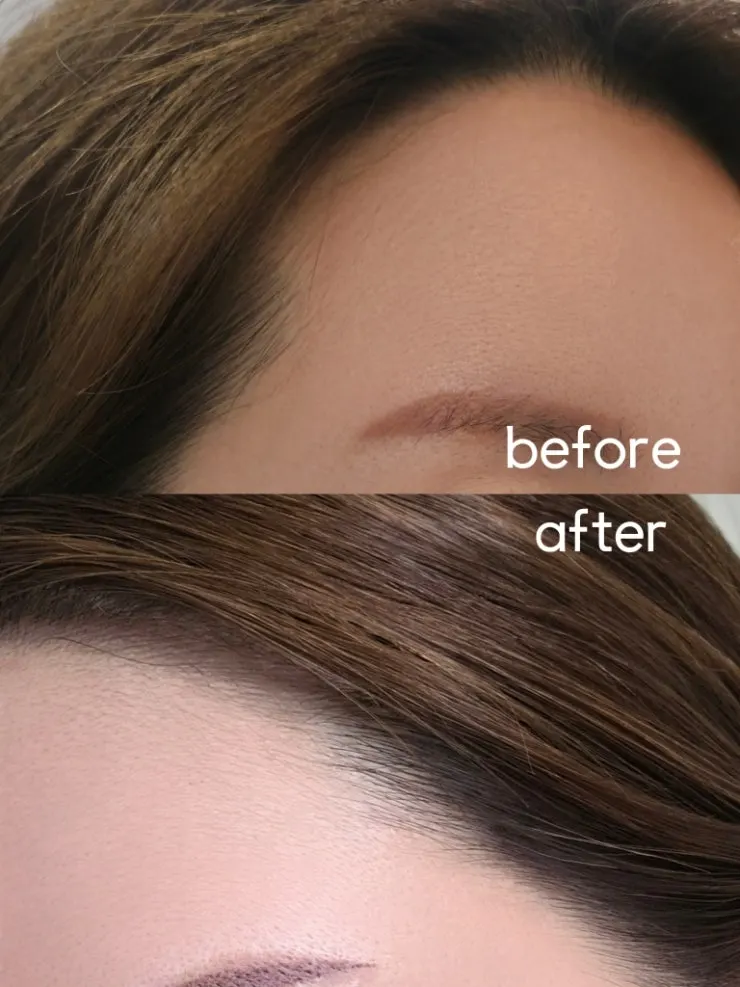 Full view of the hairline with no visible border