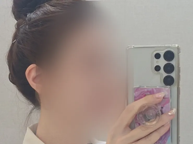 Hairline with hair tied up and no hair fluff powder used