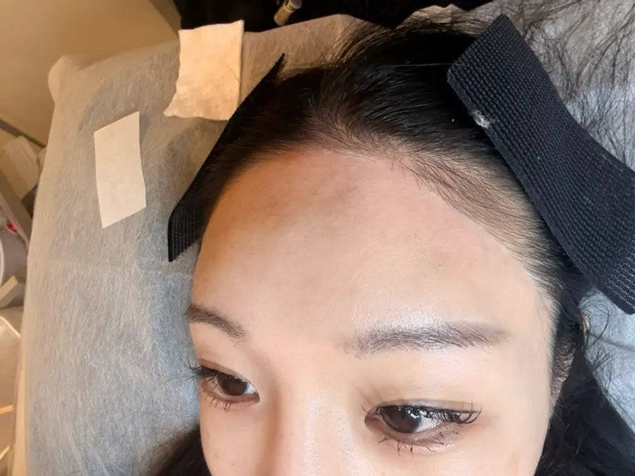 First hairline waxing experience and eyebrow waxing rebooking at Super Waxing Gangnam near Gangnam Station