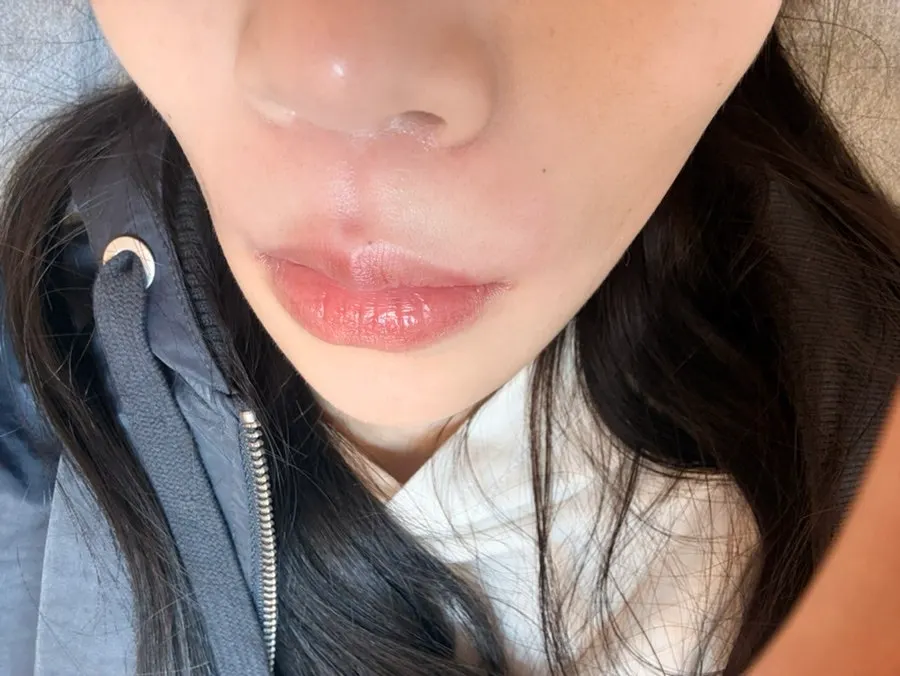 First hairline waxing experience and eyebrow waxing rebooking at Super Waxing Gangnam near Gangnam Station