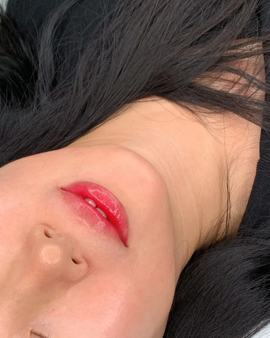 한결 밝아진 입술 컬러 시술 결과