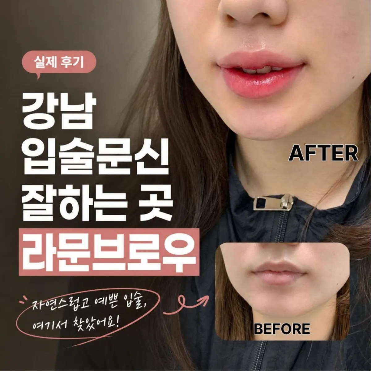 강남 라문브로우 입술문신 대표 이미지