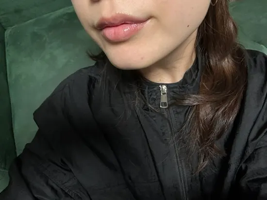 입술문신 6일차 탈각 진행 중인 입술