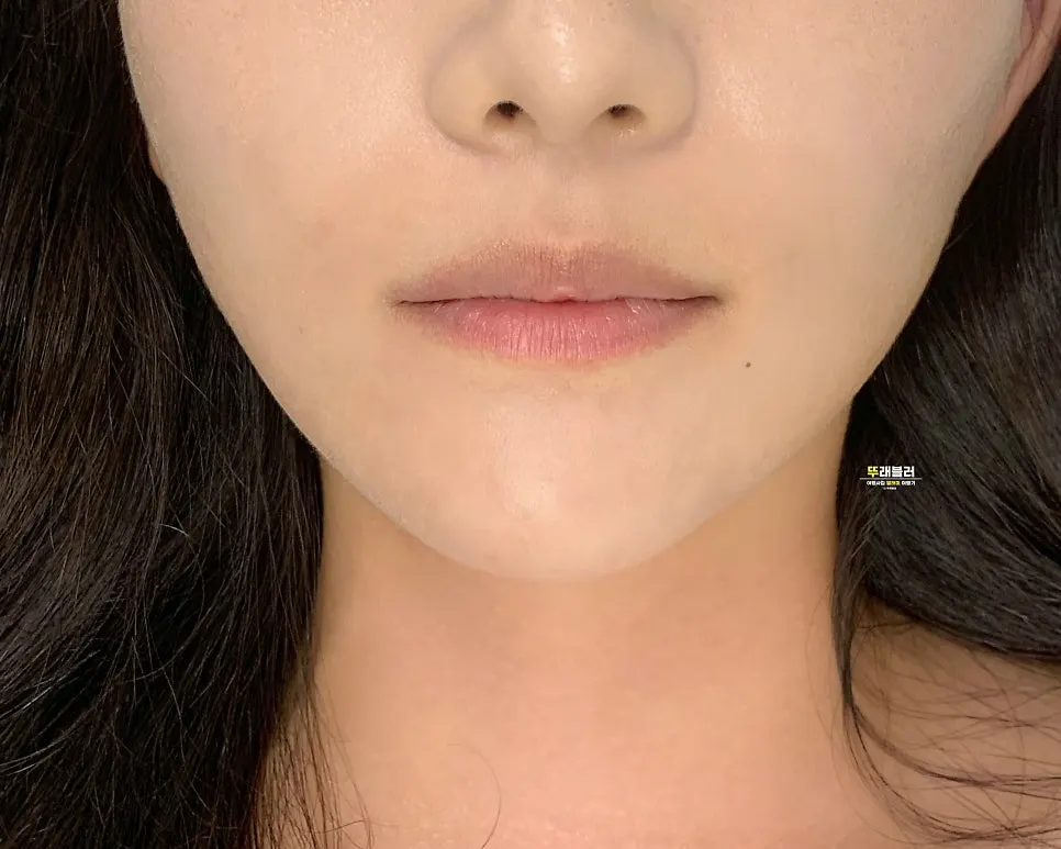 Before-and-after comparison photo of a Lamoon Brow lip tattoo