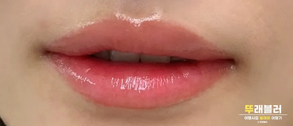 Close-up of a lip line looking more defined after the lip tattoo