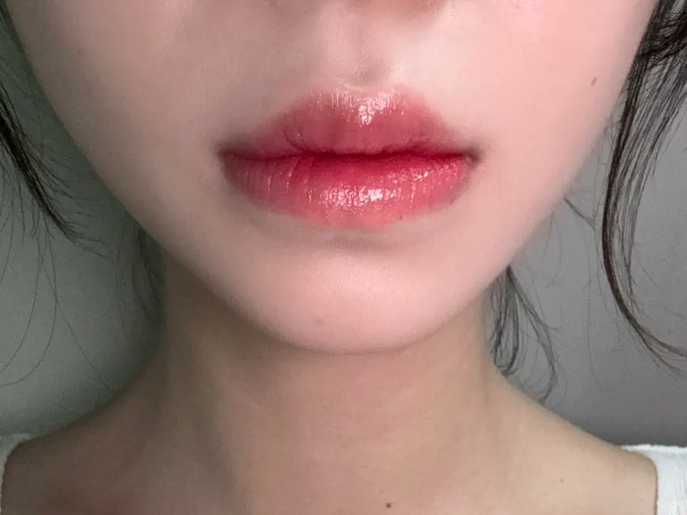 Lips after the swelling went down