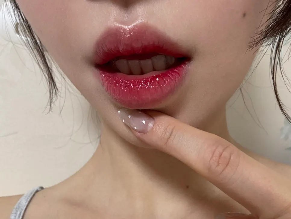 Close-up of lips with the dark line now evened out