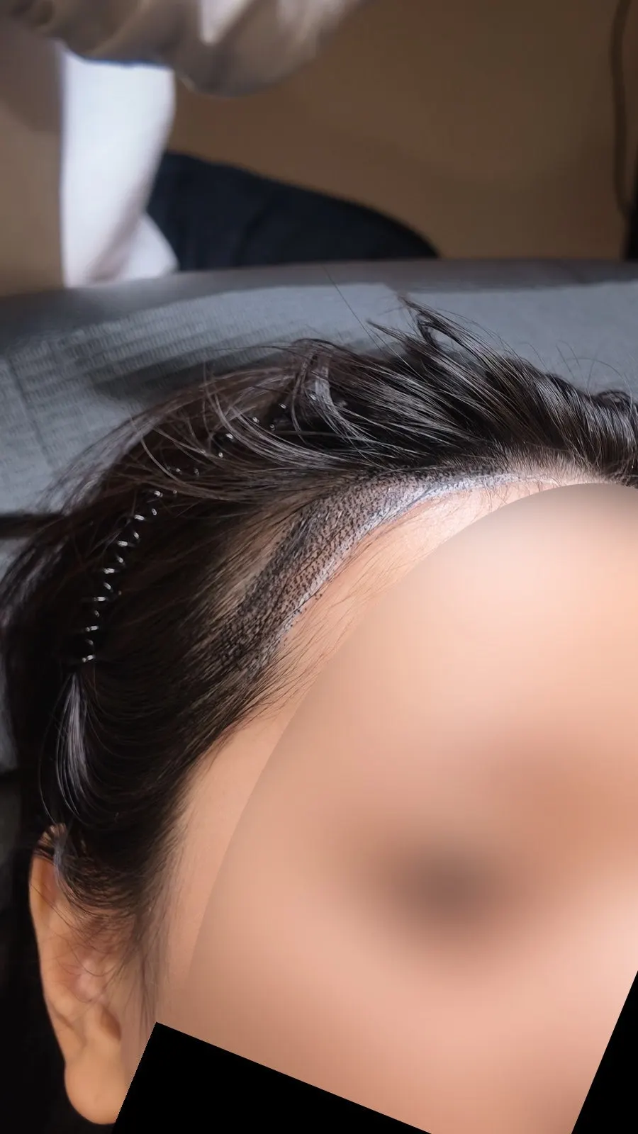 헤어라인 디자인 진행 모습