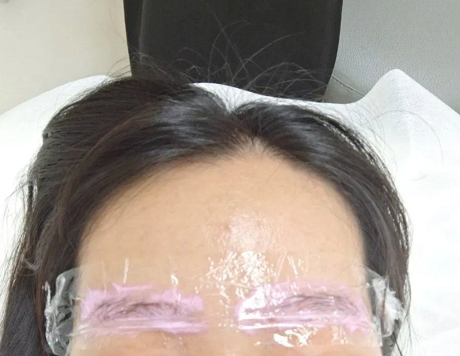 통증방지제를 바른 뒤 대기하는 모습