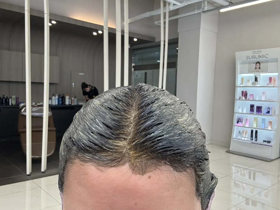 Before-and-after comparison shot