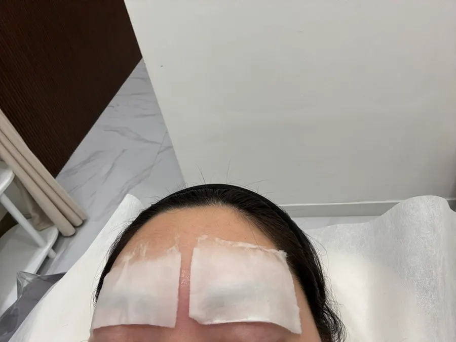 눈썹 왁싱 직후 피부 상태