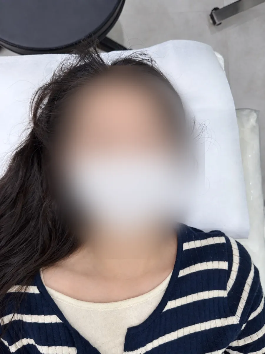 속눈썹 연장 시술 전 눈 상태
