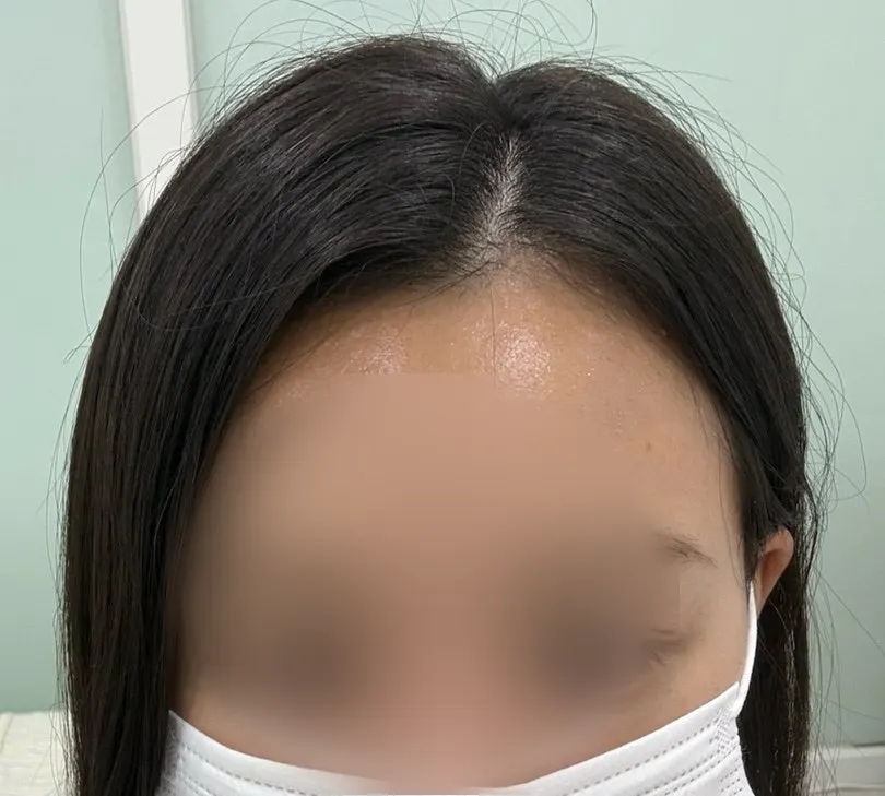 Lashes before the nutrition + black tinting lash lift