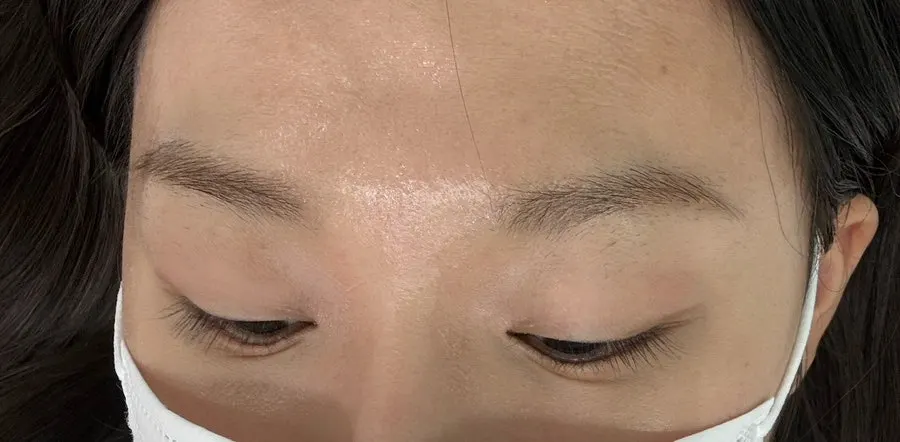 Comparison of both eyes before the lash lift