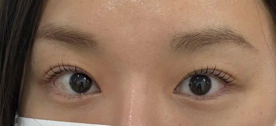 Lashes after the treatment, looking as if mascara had been applied