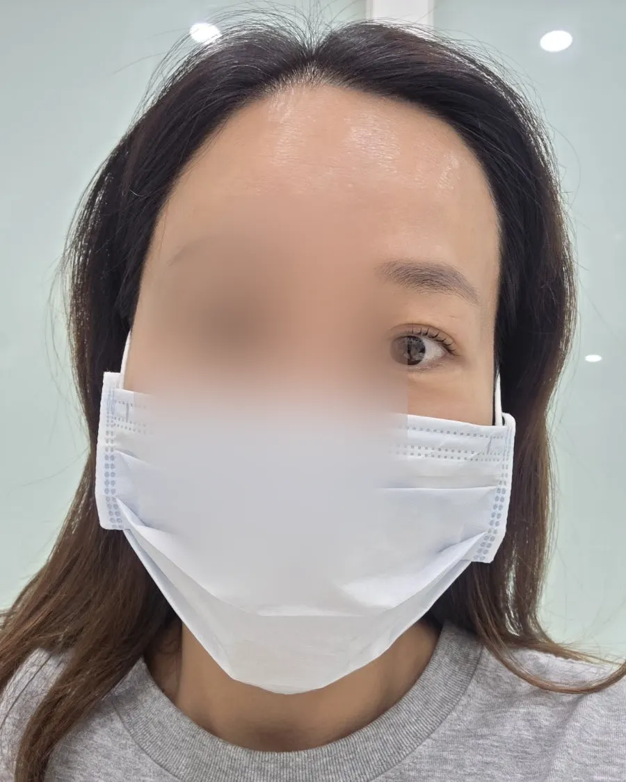 블랙틴팅으로 선명해진 속눈썹 라인