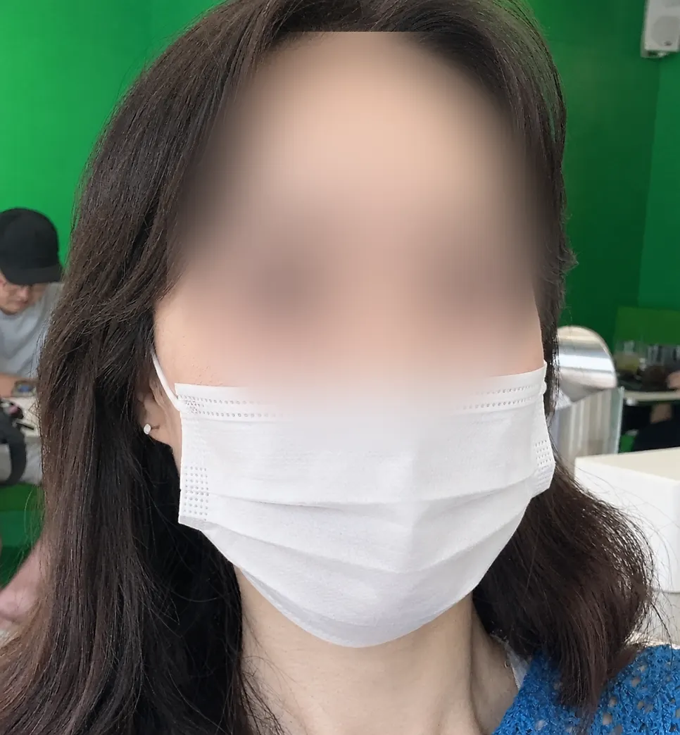 속눈썹펌 시술 전 아래로 처진 속눈썹