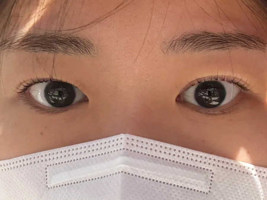 속눈썹펌 시술 전 눈매