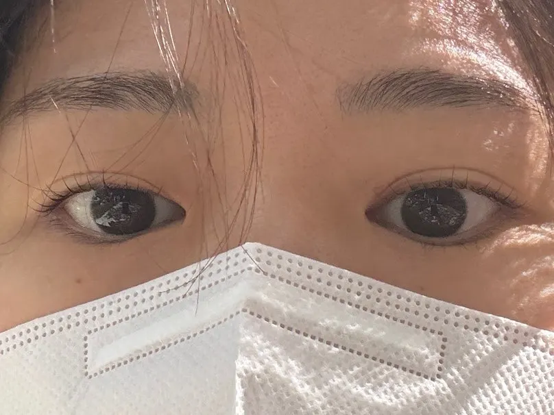 시술 2주 뒤 유지되고 있는 속눈썹