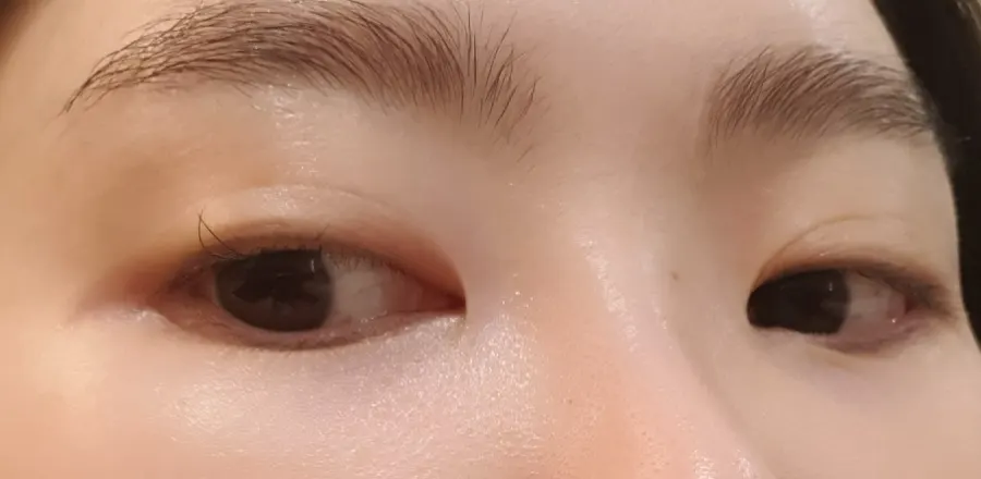 Close-up comparison photo of eyes before lash extensions