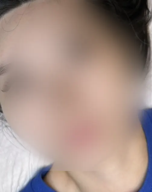 Clearer eyes after handmade Russian volume lash extensions