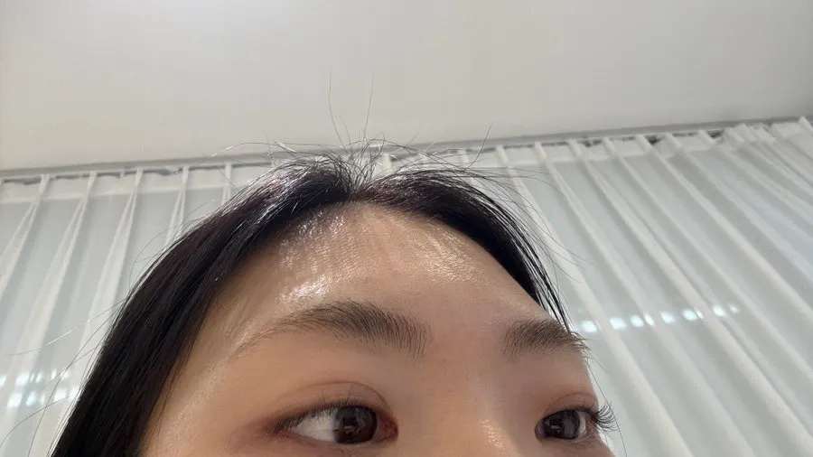 Drooping lashes before the treatment