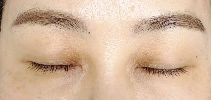 Before and after comparison of the eye area after the lash perm
