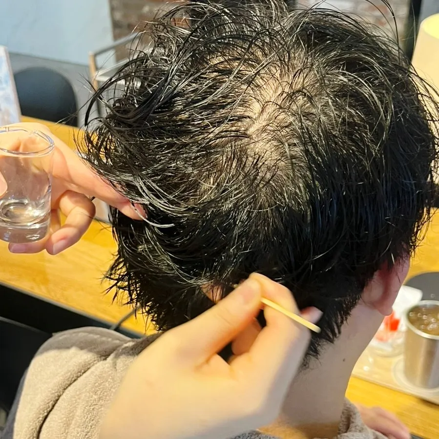 두피 스케일링 관리 과정 근접 장면