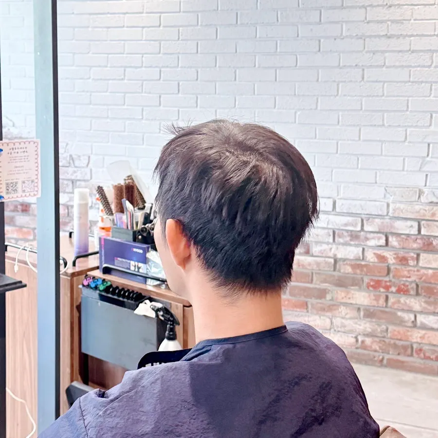 시술 전 지저분하게 자란 남자 머리 상태