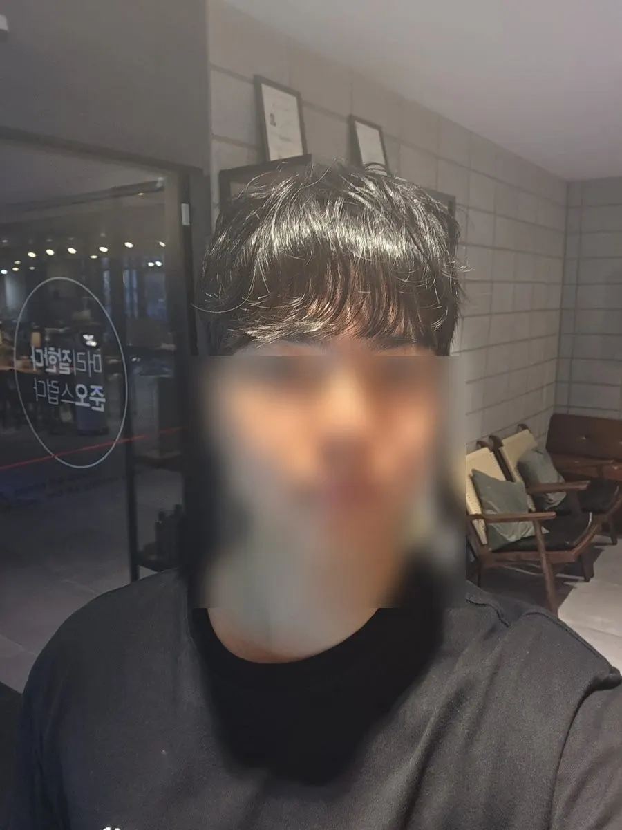 Selfie taken right after the treatment