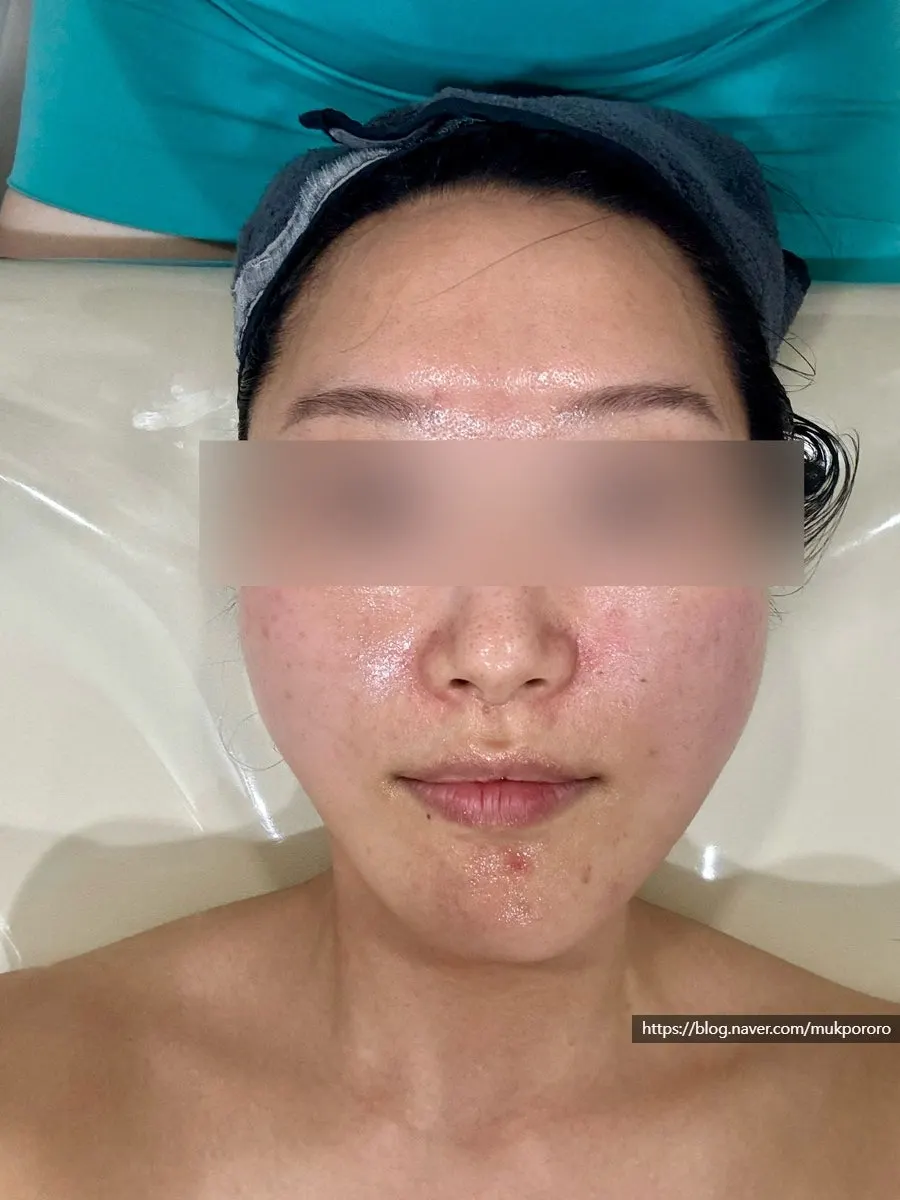 윤곽관리 뒤 피부 진정 마무리
