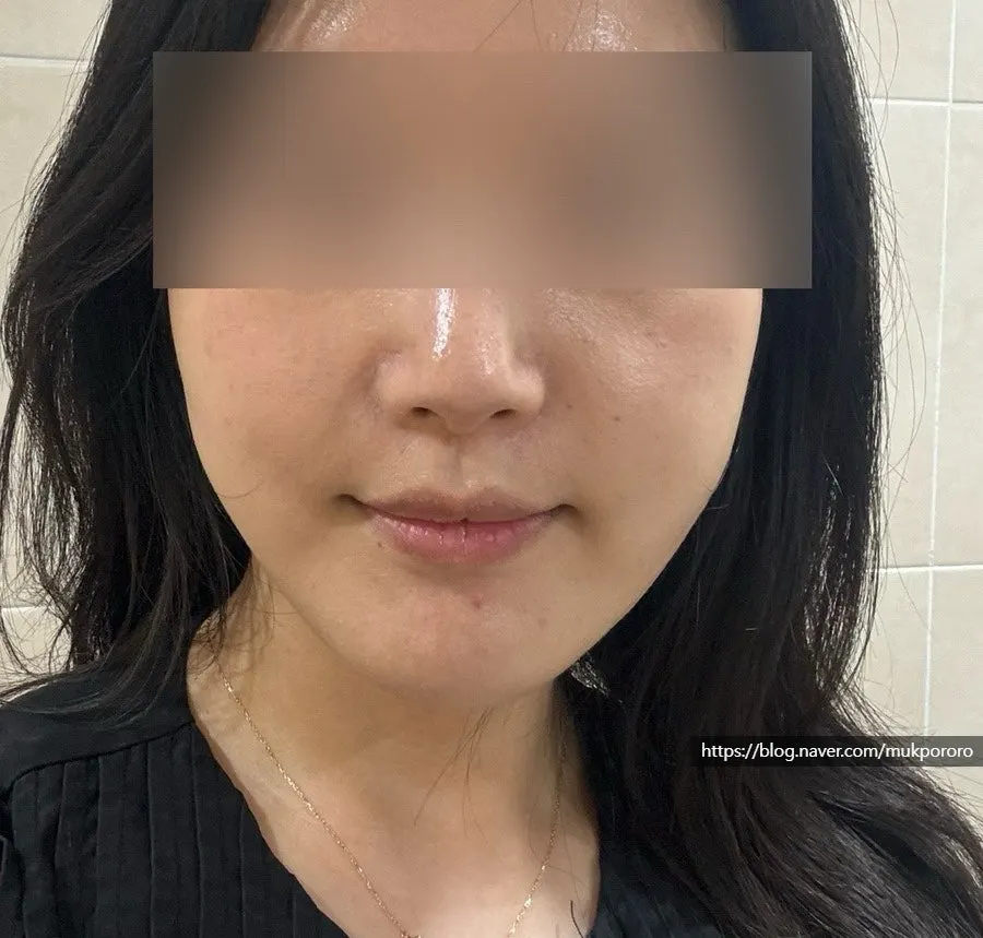 윤곽관리 후 앞볼 라인 체감