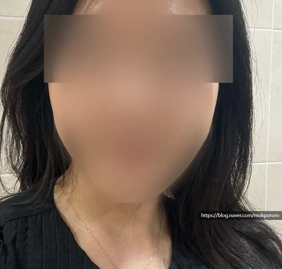 Noticing the front-cheek line after facial contouring care