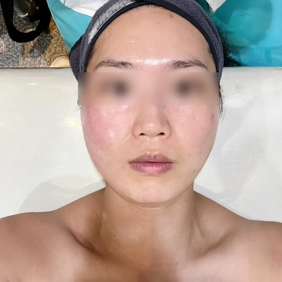 Receiving treatment while the areas being treated are explained