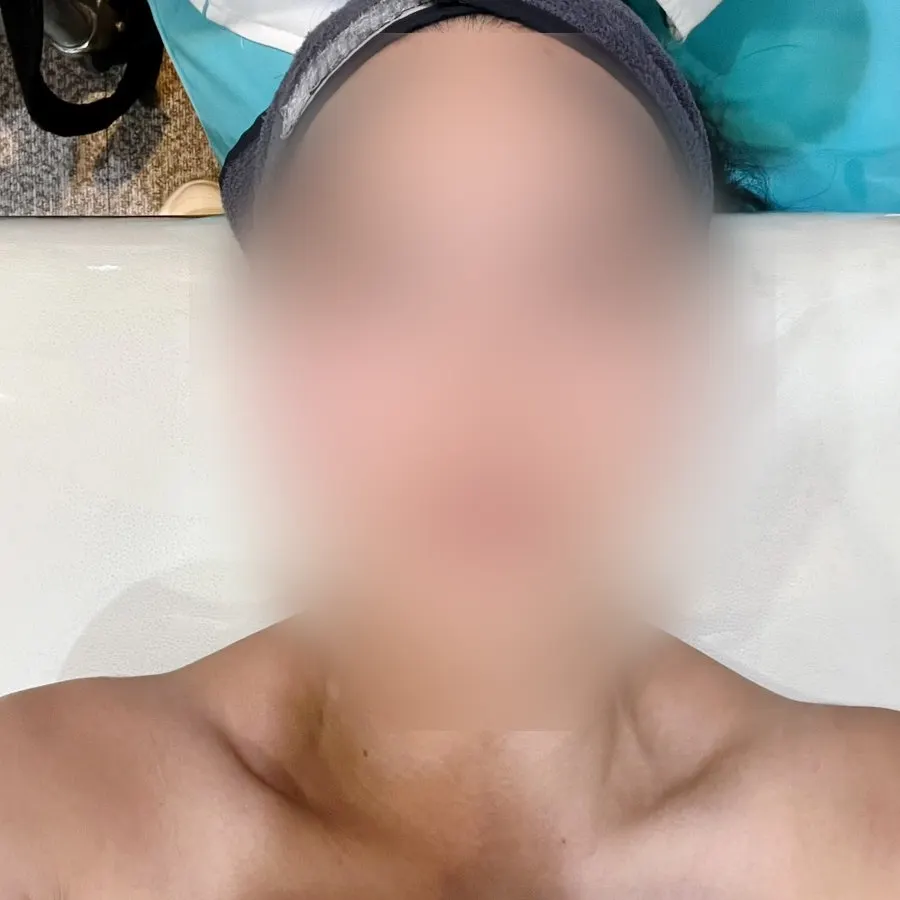 Receiving treatment while the areas being treated are explained