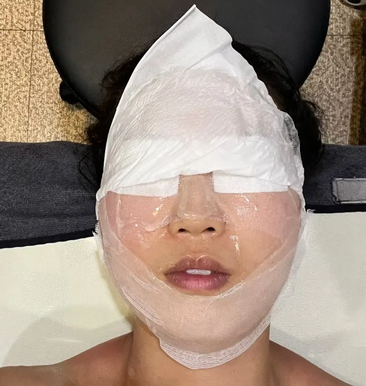 Treatment continuing from the scalp to the face line