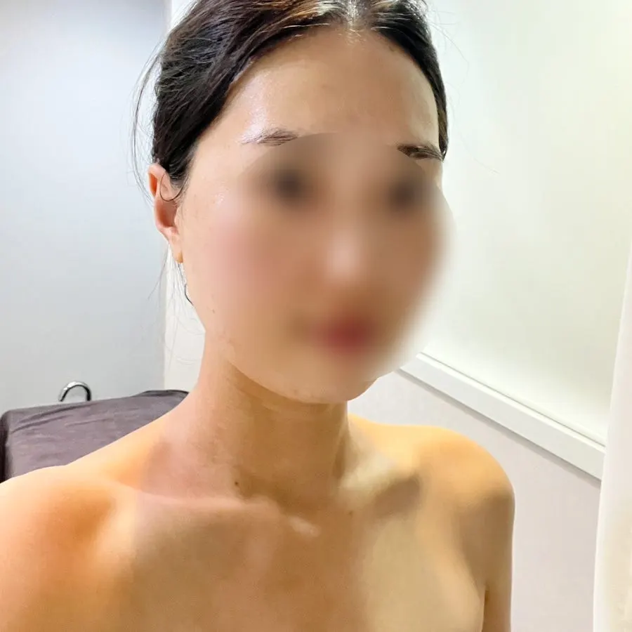 Final mask treatment process
