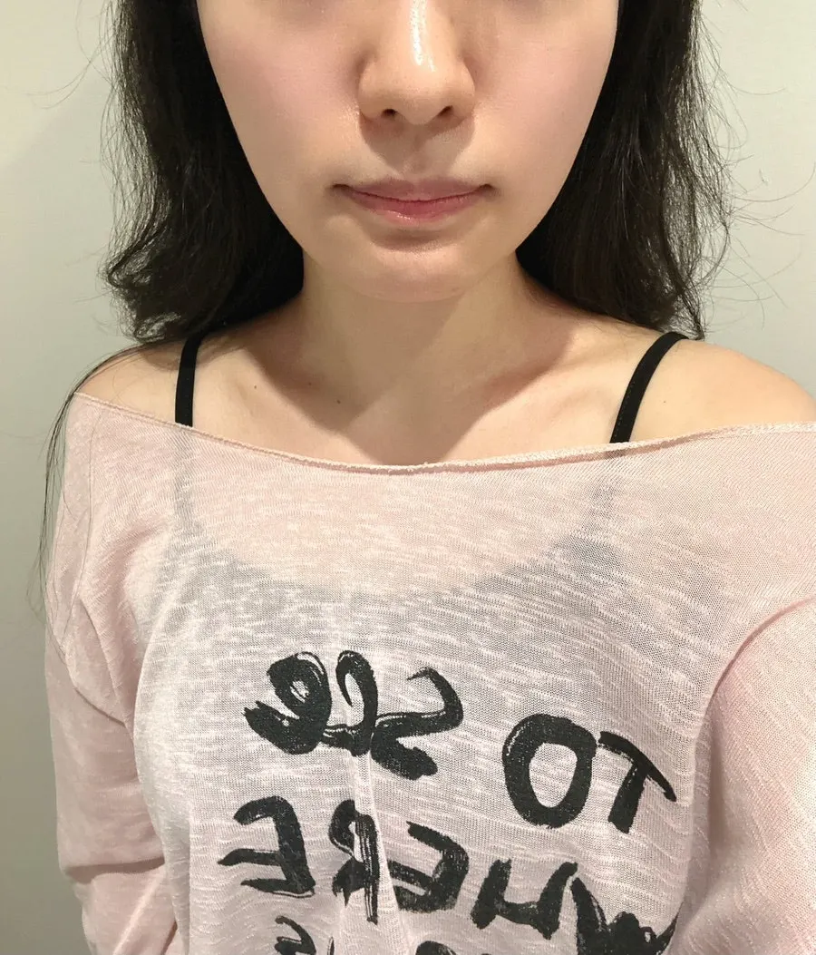 뷰태에스테틱 방문 기록 사진