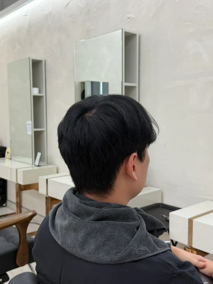 Side hair condition before the treatment