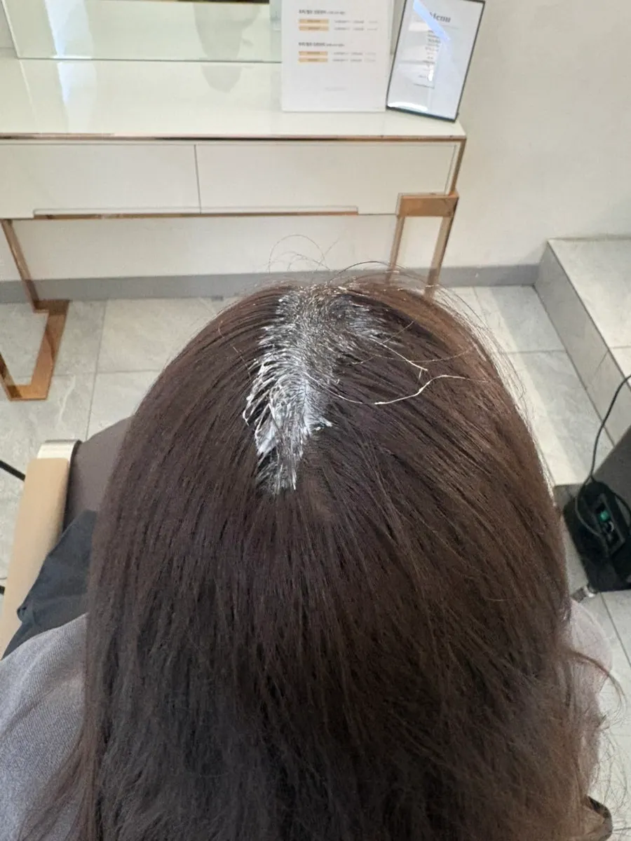 Step-by-step hair loss care process centered on the scalp